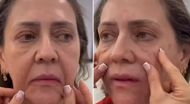 She rejuvenated by 30 years with aesthetics, and those who saw her final look said, 