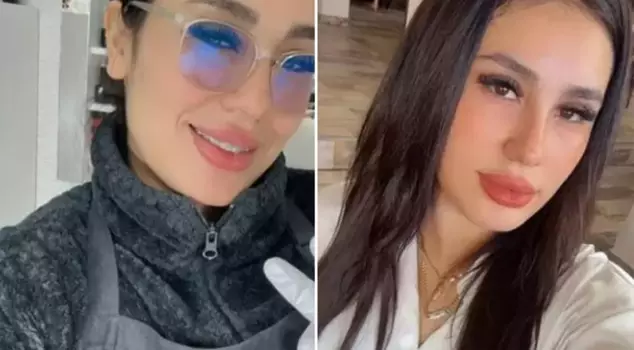 The social media influencer died during a beauty procedure.