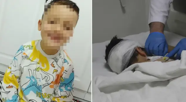 The little boy was seriously injured in an attack by street dogs.