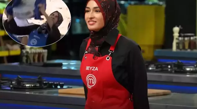 MasterChef Beyza shared a photo of her burned face with the note 