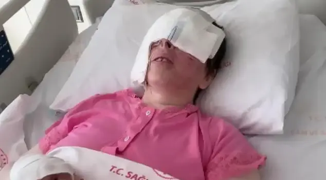 The woman who had acid thrown on her face: I cry every day, blood comes from my eyes.