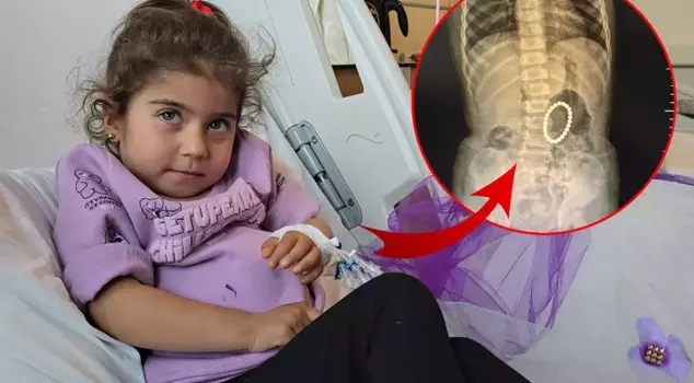 The things that came out of the 4-year-old child's intestines shocked everyone, 