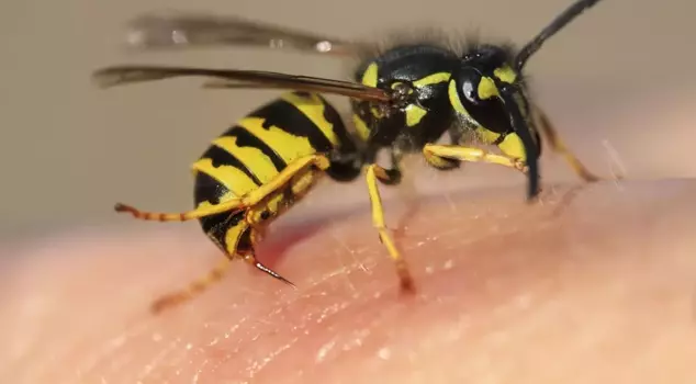 The young woman who was stung by a bee has passed away.