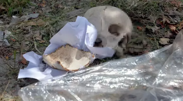 A human skull was found in a trash container! The initial assessment is horrifying.