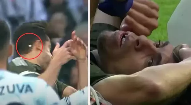 Unlucky streak in Beşiktaş! Two injuries and one player with a broken tooth.