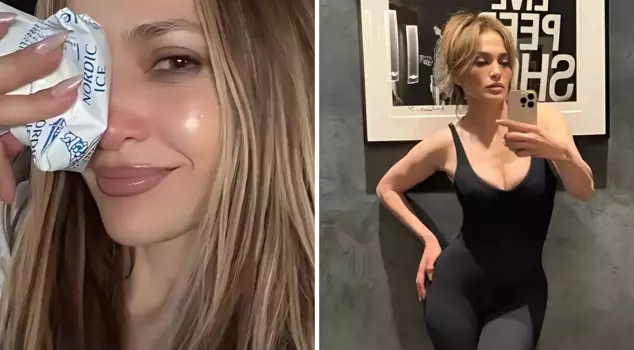 Jennifer Lopez was injured on her face during rehearsals for the American Music Awards.