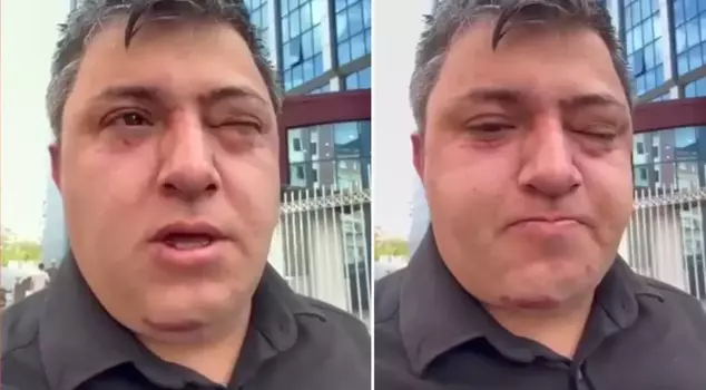 Serious allegation: Altındağ Mayor Tiryaki assaulted a municipal worker.