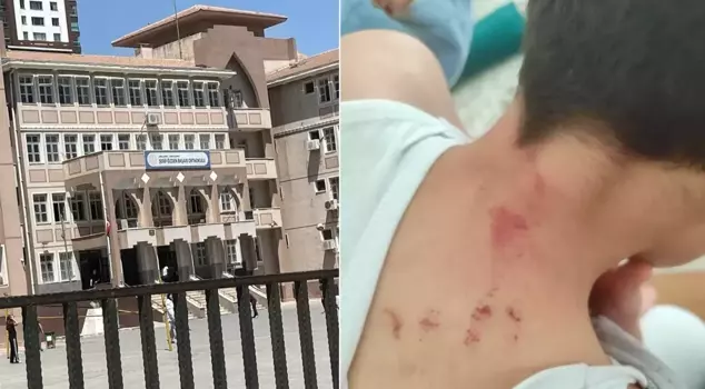 The teacher who hit his student has been arrested.