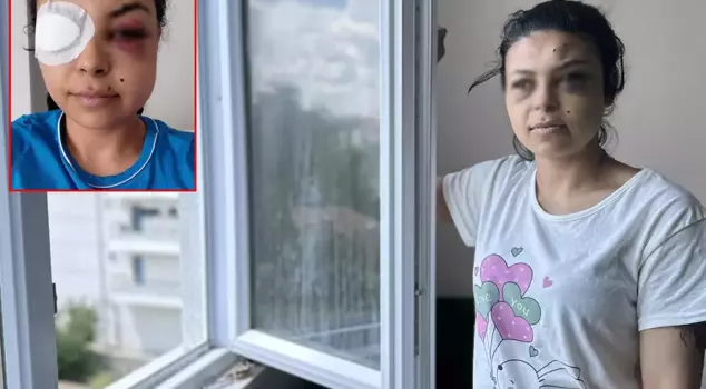 While watching the wedding from the window, she was struck in the eye: My life is over.