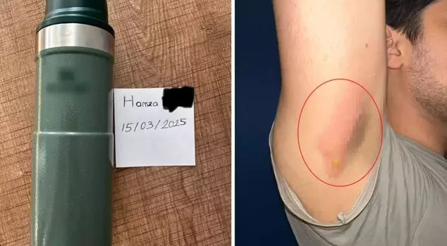 The thermos from the world-famous brand sent the young man to the hospital.