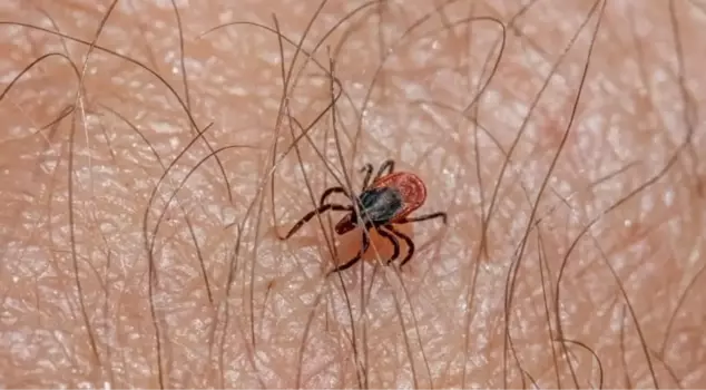 A mother of three children died from a tick in Kayseri.