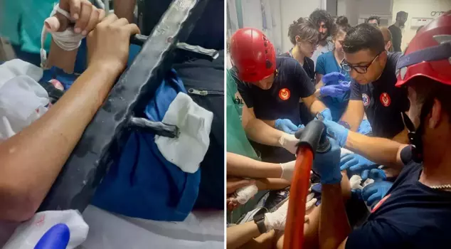 A 13-year-old boy fell from a tree and impaled his body on a metal railing.