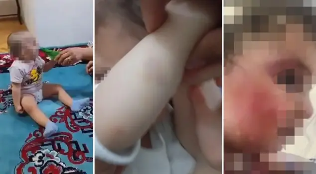 The mother who beat her 1.5-year-old child and concealed the injuries with foundation is facing a request for 2 years in prison.