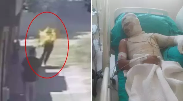 He burned his nephew alive like this.