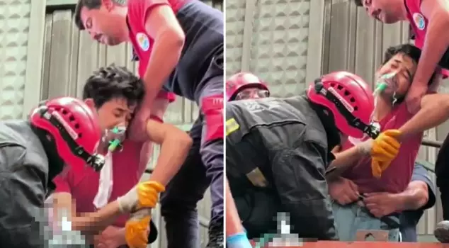 Devastating images! He lost both of his legs at a young age.