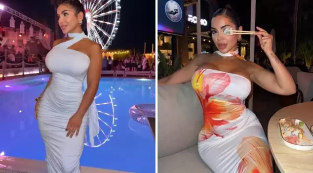 The robbers broke into the home of the beauty phenomenon, burned her face, and raped her.