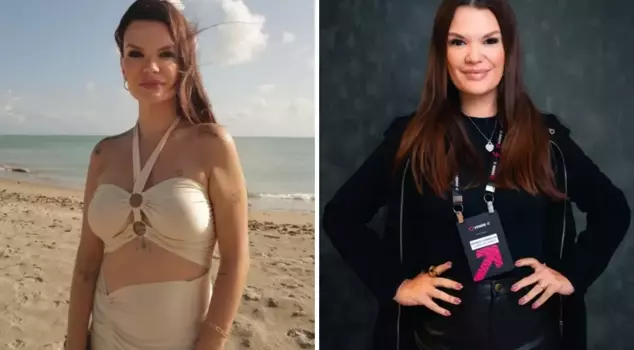 A woman who was a phenomenon and had her heart stop during cosmetic surgery has passed away.