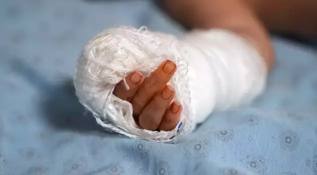 The nurse accidentally severed the baby's finger while removing the IV.