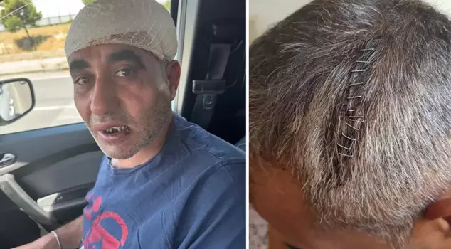 He was beaten to death with kicks, punches, and clubs at the entertainment venue.