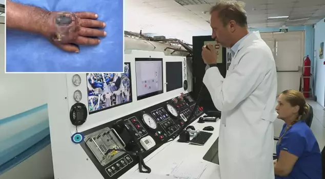 Even the doctors were surprised! The thief bit his hand so badly that the case is about to enter the literature.