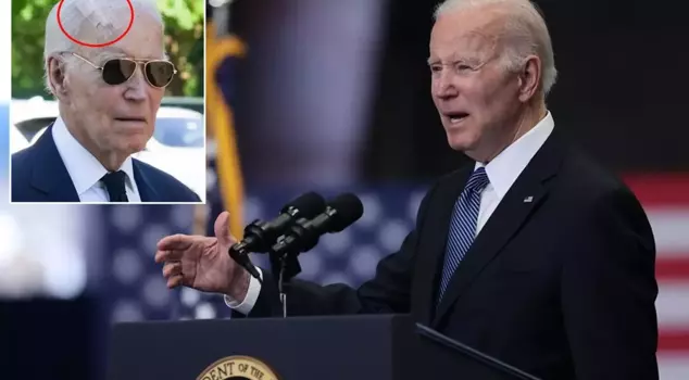 Former U.S. President Joe Biden underwent skin cancer surgery.