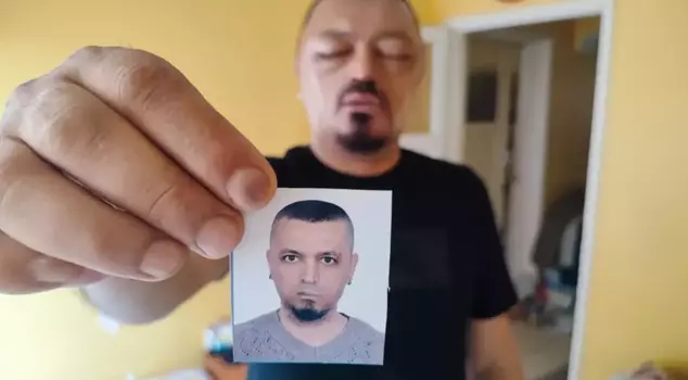 He followed the barber's advice and ended up in a worse condition than a bee sting.