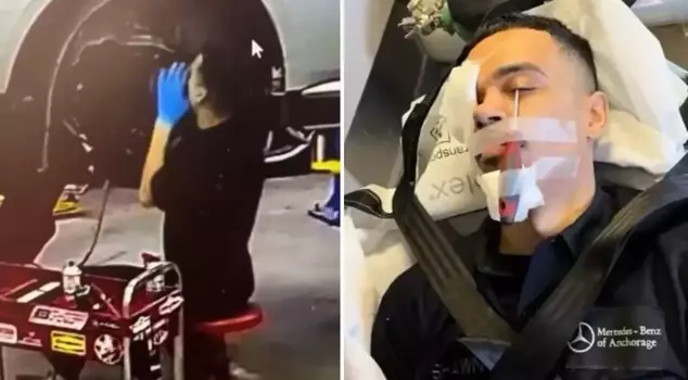 Scary accident in car repair! A screwdriver got stuck in the worker's eye.