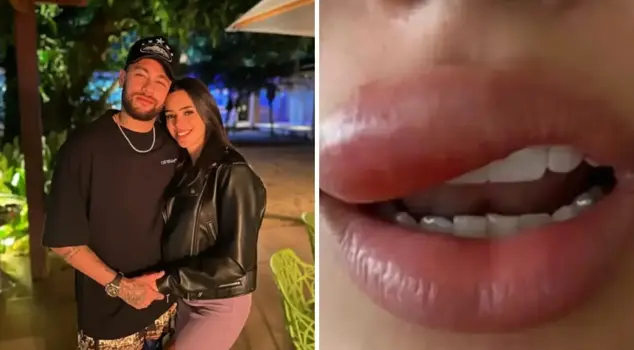 The fiancée of the famous football player, who has a pimple on his lip, has become unrecognizable.