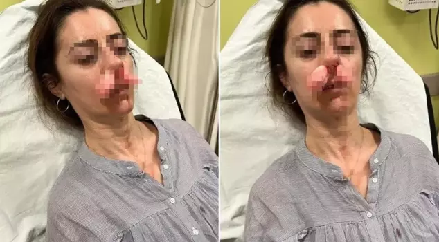She had beaten him to death, thinking he was her husband's lover! The car door was considered a weapon.