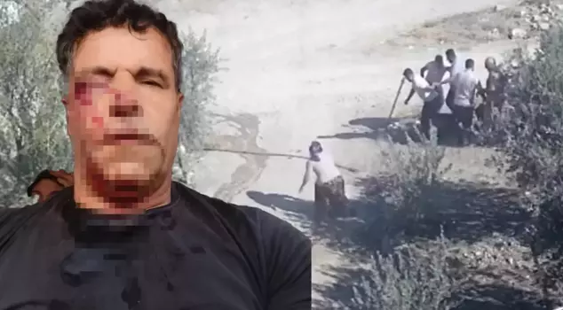 They wanted to crush his head with a stone, but his wife intervened without thinking.