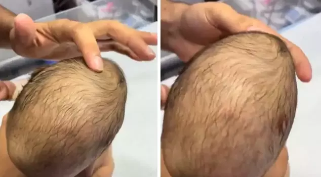 The scene the doctor sees when pressing on the newborn baby's fontanel is horrifying.