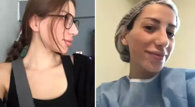 She had nose surgery at the state hospital! Here is the transformation the young woman experienced.