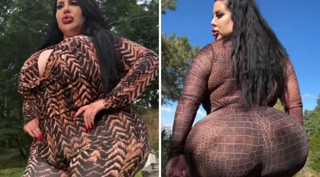 She wanted to have the biggest hips in the world! The result was horrifying.