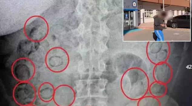 The things that came out of his stomach made people say, 