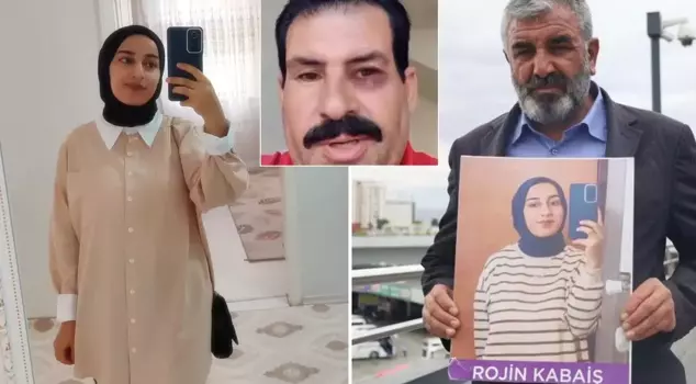 New video from the person who insulted Rojin Kabaiş: They made my eyes completely black.