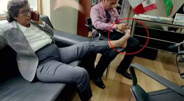 The country is standing strong! The leftist deputy had their toenails trimmed.