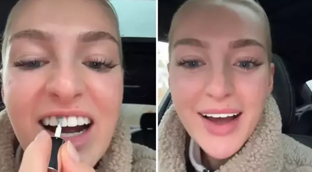 The incredible thing she does to whiten her teeth!