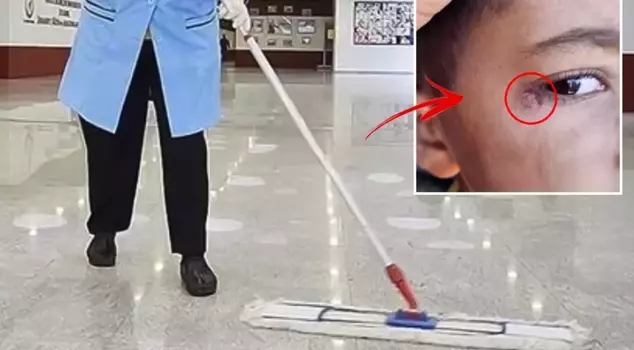 Elementary school horror! The janitor extinguished a cigarette on little Mustafa's face.