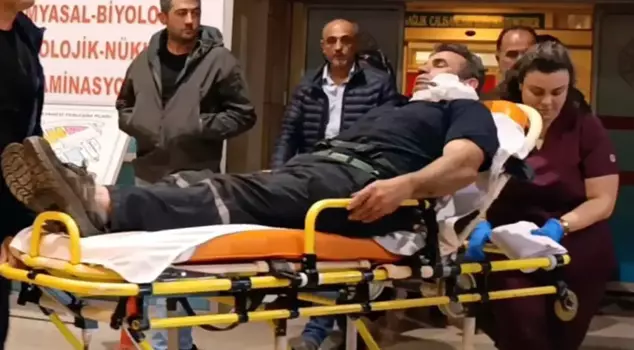 While unloading the coals, a piece of iron got stuck in his face.