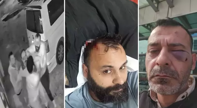 The famous phenomenon was brutally beaten by his wife and family.