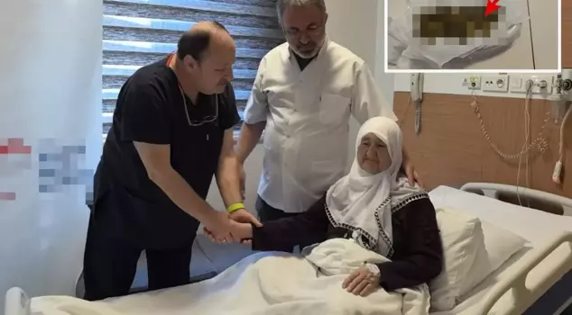 The elderly woman had 213 stones removed from her gallbladder.