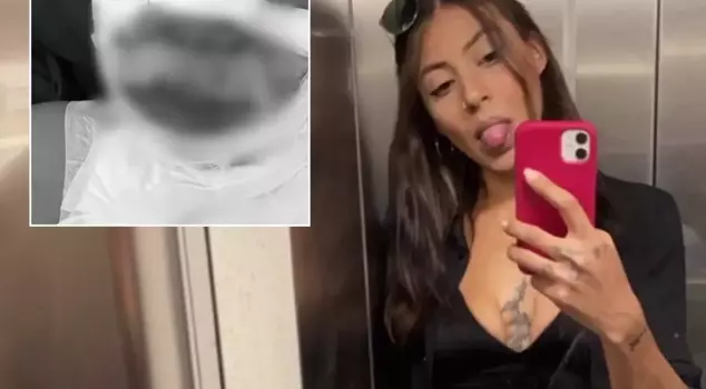 A woman was set on fire in a luxury neighborhood of Istanbul! She asked a single question and then lit the match.