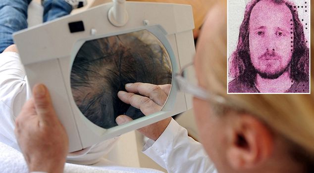 A British man who had hair transplants and dental work suddenly collapsed and passed away.