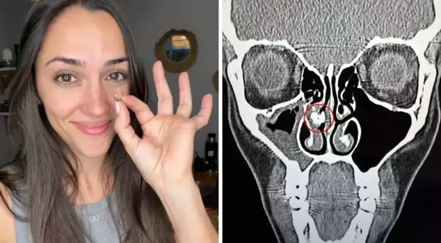 The truth that emerged after 35 years: No one believed what came out of his nose.