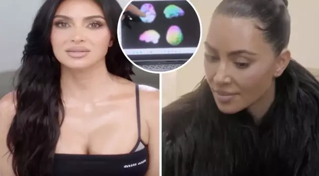 Kim Kardashian's brain scan showed 'low activity.'