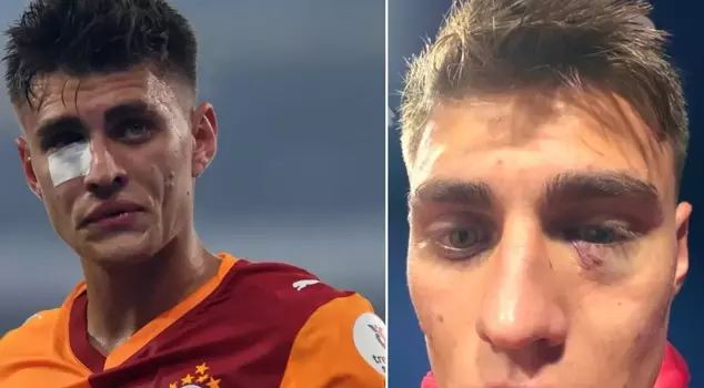 A decision has been made regarding the person who threw a lighter at Kazımcan Karataş.