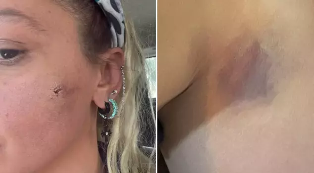 يليز أسيالي أعلنت أنها تعرضت للعنف من زوجها.