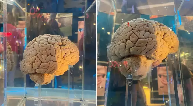 The massive archive in Amsterdam: 5,300 brains will be mapped with artificial intelligence.