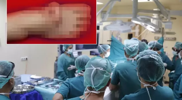 An unprecedented event! He carried his ear on his foot for 5 months.