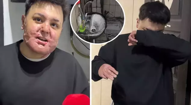 65 операций, 12 дней в коме! Его жизнь превратилась в кошмар за считанные секунды.